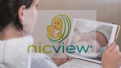 NicView Login: Access Nicview.net with No Problem